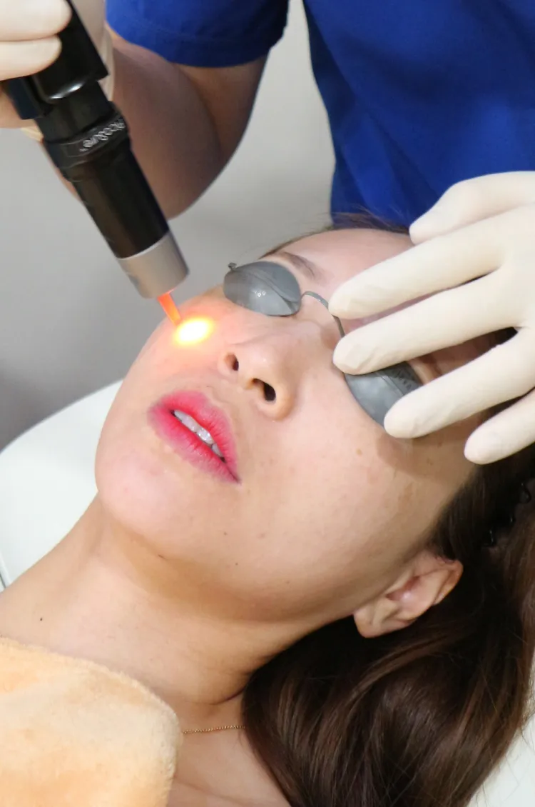 Pico Laser Treatment in Dubai