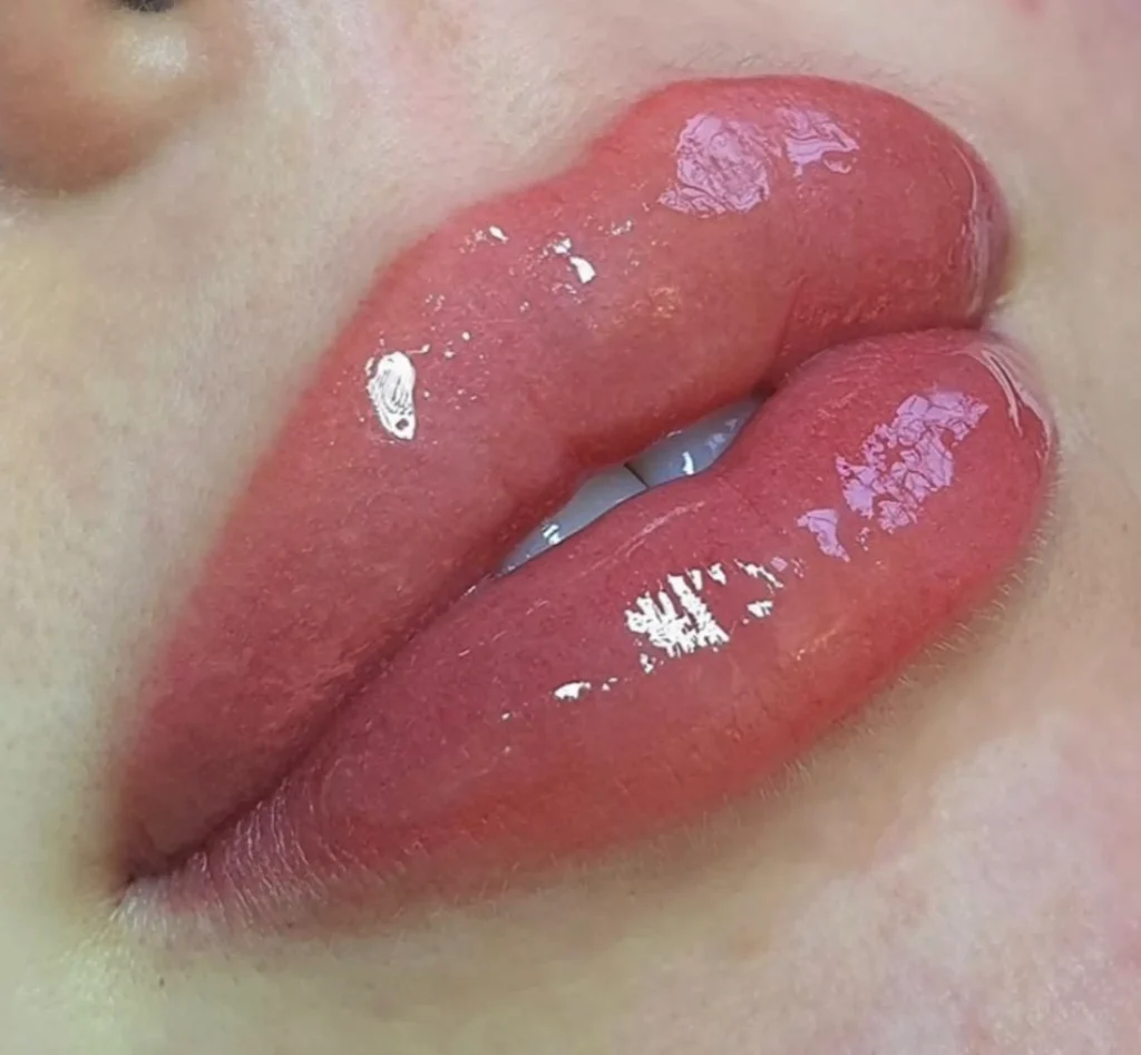 Permanent Lip Blushing Treatment in Dubai